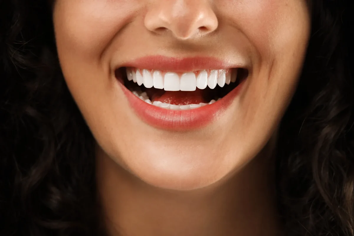 Close-up of a woman's bright white smile